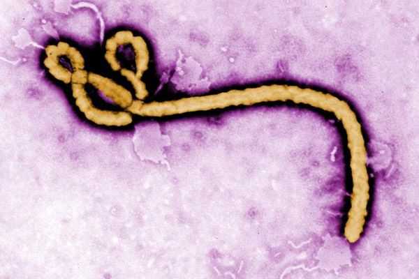 ebola virus under microscope