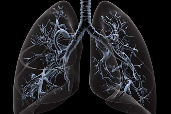 x-ray of lungs