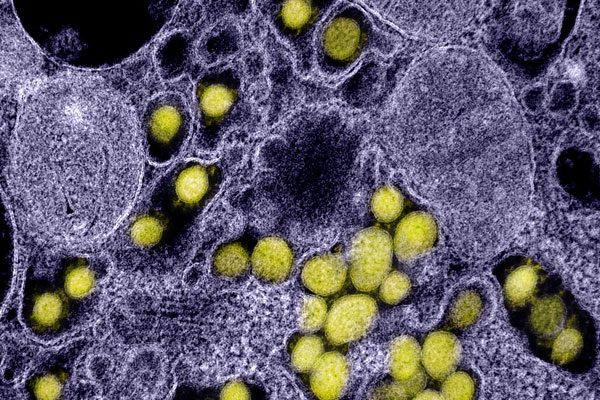 covid-19 under microscope
