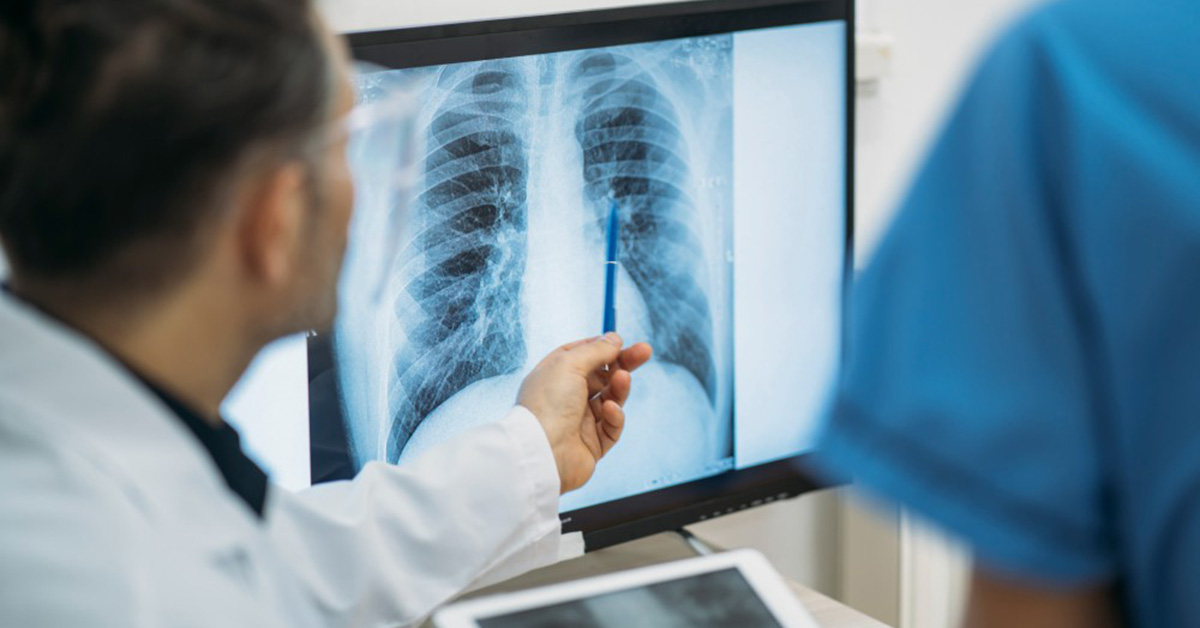 A providers points to lungs in an x-ray.