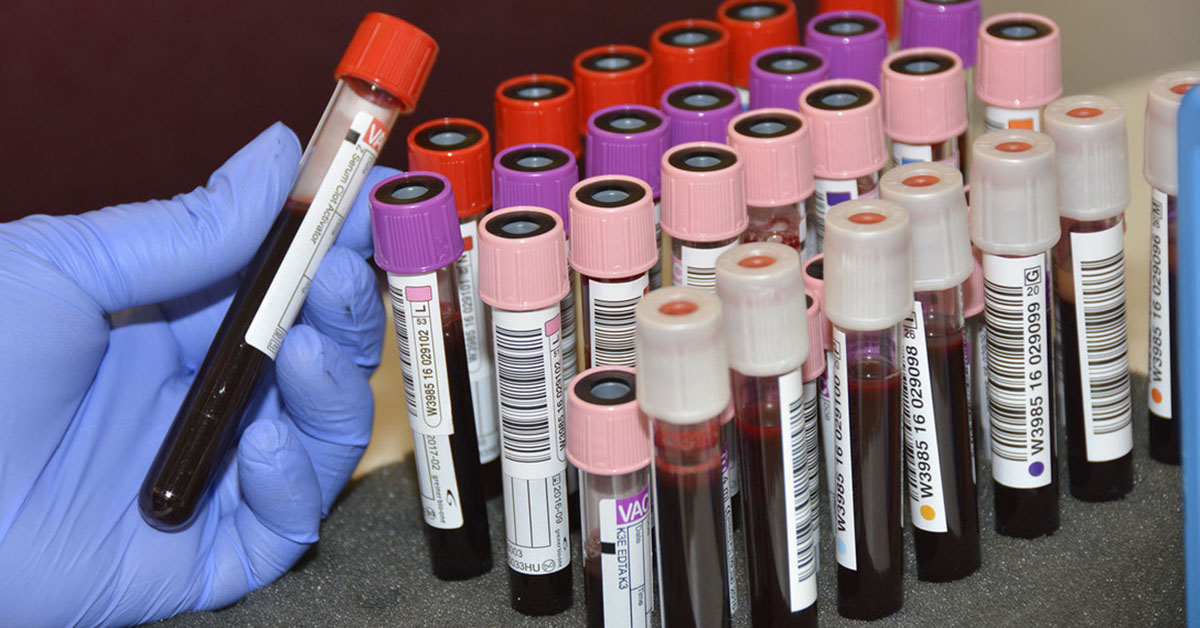 A gloved hand holding blood samples vials.