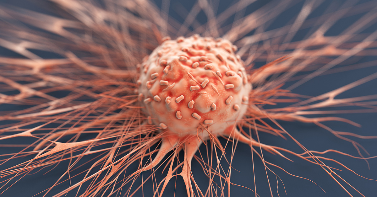 An illustration of a human cancer cell.